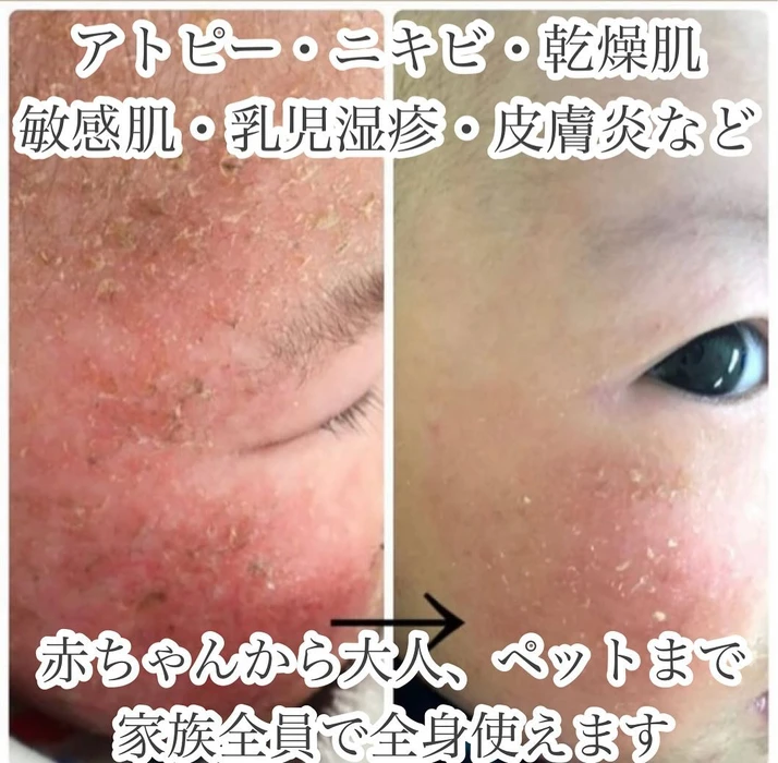 画像722